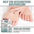 thumbnail image 4 of 10ml Fungal Nail Treatment Nail Foot Whitening Toe F, 4 of 4