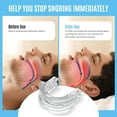 thumbnail image 5 of Anti Snoring Device Mouthpiece, Professional Comfortable&Adjustable Snore Mouthpiece,Snoring Solution for Men/Women Better Sleep, 5 of 7