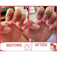 thumbnail image 2 of Endurecedor de uñas MAVALA Scientifique K+ Keratin 5 ml, 2 of 9