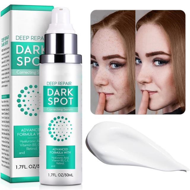 Cremas e Hidratantes Crema Aclarante Hidratante e Iluminadora Aclara y Repara Mejora la Tez Opacada Elimina la Melanina e Ilumina el Rostro 50ml Crema Facial