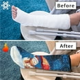 thumbnail image 7 of COEQINE Christmas Snowmans Leg Cast Cover Broken Leg Shower Cast Cover Below The Knee Leg Cast Sleeve Soft Leg Plaster Sleeve Decorative Leg Plaster Cover for Kids Girls Small, 7 of 7