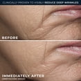 thumbnail image 5 of RoC Retinol Correction, Deep Wrinkle, Rich Cream 1.7oz, 5 of 13