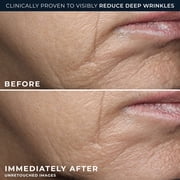 RoC Retinol Correction, Deep Wrinkle, Rich Cream 1.7oz
