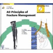 Principles of Fracture Management (Paperback)