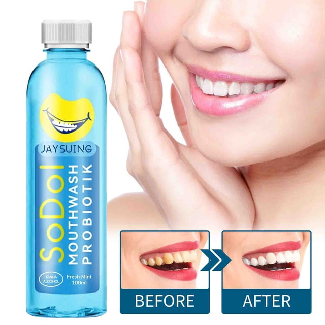 Enjuague bucal Xihbxyly 100 ml Eliminación de sarro Blanqueamiento dental