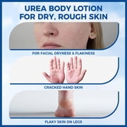 OUKEYA 10% Urea Cream Body Lotion Softens & Soothes Dry Chapped Skin, Face Elbow Lotion 11.28 oz