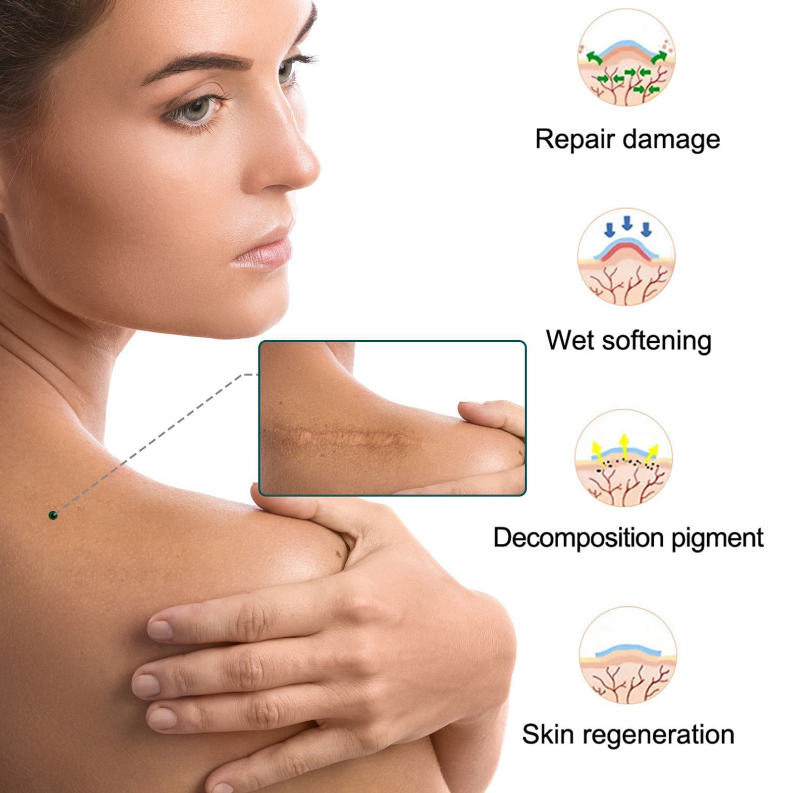 Washranp Upgrade Scar Repair Roll Sticker,Nonirritating SelfAdhesive