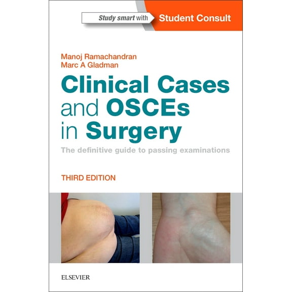 Clinical Cases and OSCEs in Surgery