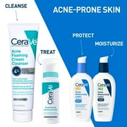 Cerave Acne Foaming Cream Cleanser with 4% Benzoyl Peroxide, Hyaluronic Acid, Niacinamide Cream-to-Foam Formula 5 fl oz