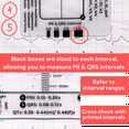 thumbnail image 4 of 2pcs ECG 7-Step Ruler Rapid and Rapid Heart Analysis and Measurement Tool, Follow 7 Steps to Read ECG, 4 of 4