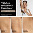 thumbnail image 3 of Braun Silk-Expert Pro 5 IPL PL5157 at Home Laser Hair Removal for Women and Men with Premium Pouch, 2 Heads, Venus Razor, 3 of 13
