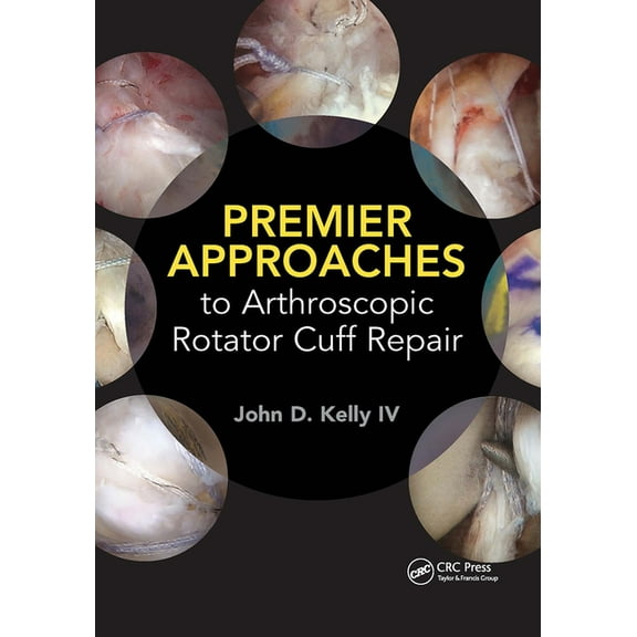 Premier Approaches to Arthroscopic Rotator Cuff Repair, (Paperback)