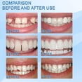 thumbnail image 3 of Jaysuing 30ml Dientes postizos moldeables Partículas blancas Reutilizable No tóxico temporalmente Jaysuing 30ml, 3 of 7