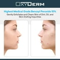 thumbnail image 3 of Oxyderm Benzoyl Peroxide 10% Cleanser Wash Treatment - Clears Cystic Breakouts & Fights Acne.  Prevents Future Pimples, Blackheads, Whiteheads, Zits, Bumps, 3 of 5