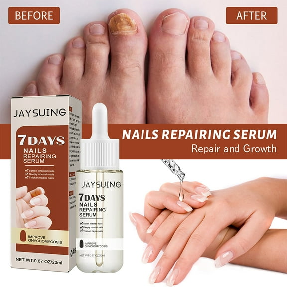 7 Days Nail Growth and Strengthening Serum Nail, Nail Serum Repair Essence, Nail Cuticle Oil Strengthener, Nail Repair Solution, Ends Cracking, Splitting and Peeling, 20ML