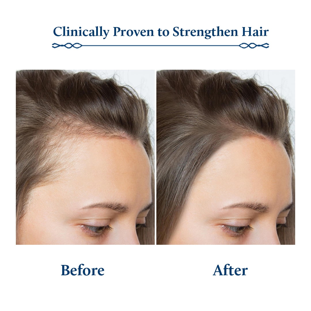 Blue Nectar Hair and Healthy Scalp Cleanser Shampoo for damaged hair (10 Herbs, 6.76 Fl oz)
