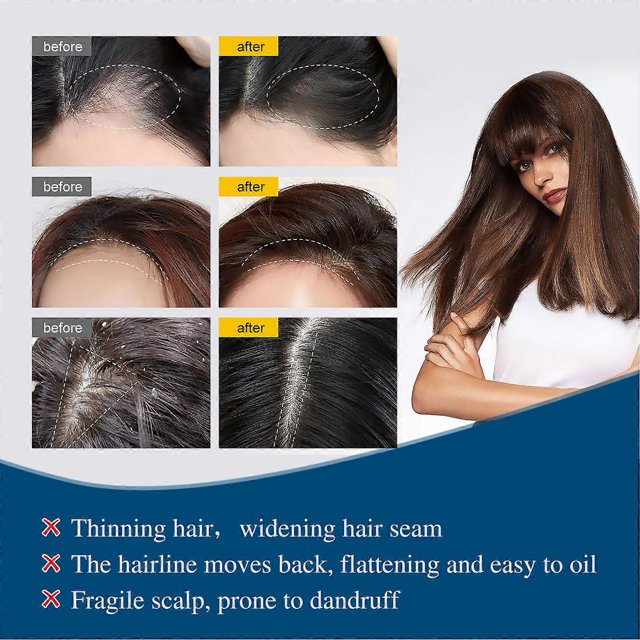 Pack of 5 ampoules for hair growth, nourishing and strengthening serum for men and women