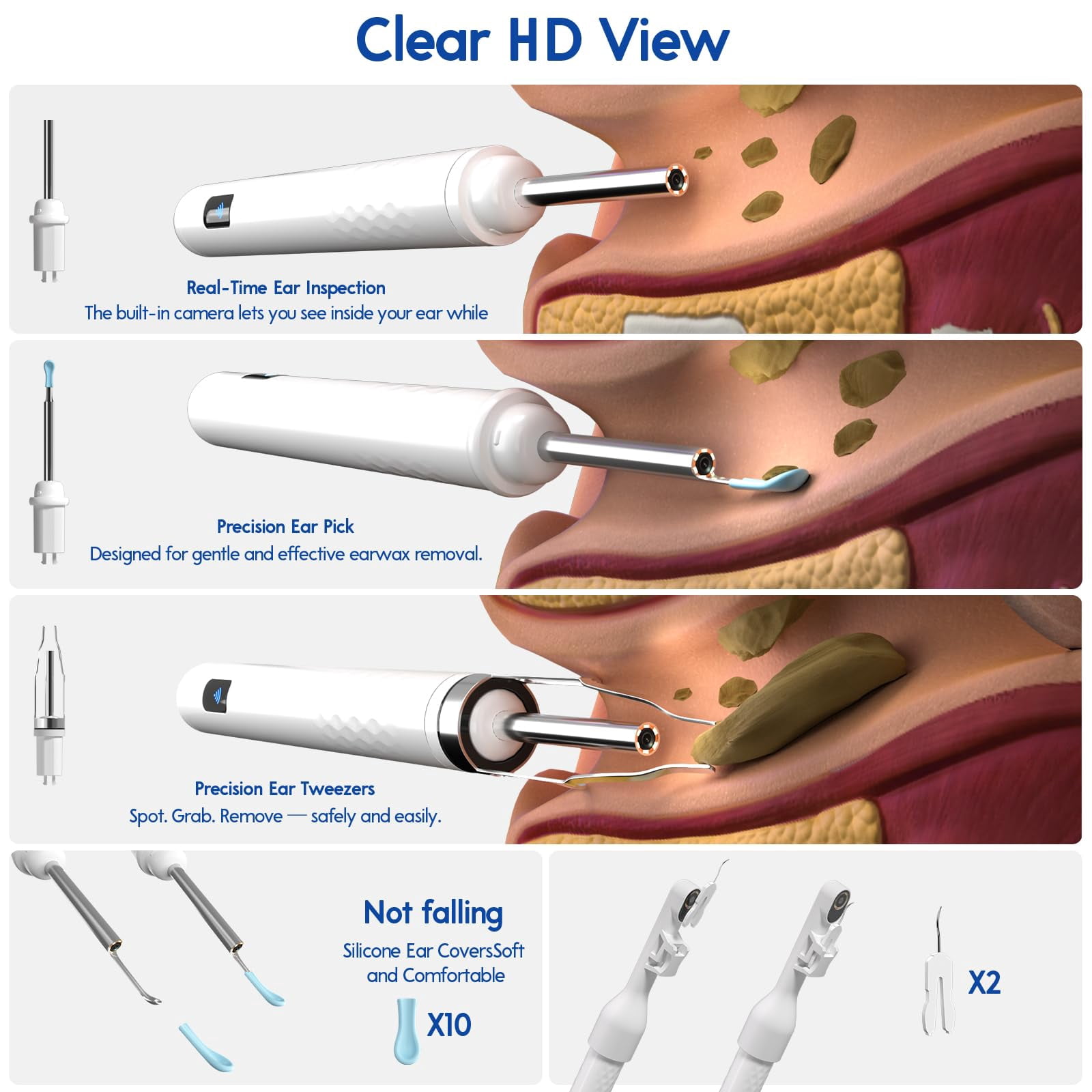 Ear Cleaner with Camera, Wireless Ear Wax Removal Tool with Screen, Visual Ear Cleaner Kit with Tweezers and Replacement Tips, Safe Ear Cleaning Tool for Kids & Adults