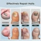 thumbnail image 4 of Nail Fungus Laser Treatment Device for Toenails & Fingernails, Home Use 905nm Infrared Light + 470nm Blue Light for Nail Repair 2025, 4 of 5