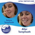 Temptooth 1 Selling Temporary Tooth 200 ct, Do It Yourself Temporary Tooth Replacement