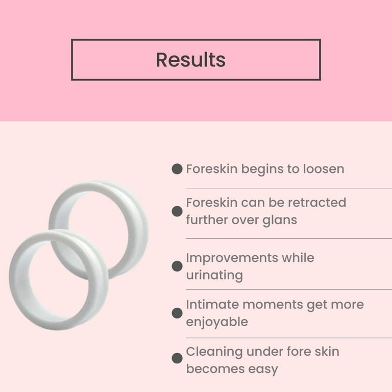 CauseHuman Phimosis Stretching Rings Set (20 Rings) - Medical Grade  Silicone for Safe & Effective Phimosis Stretching - Proven Results in Skin