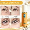 thumbnail image 4 of HYLLai Lutein Brightening Eye Oil – Roll-On Serum for Dark Circles & Firming, 8ml, 4 of 9