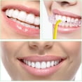 thumbnail image 4 of ERNITES 30 Pcs Aligner Removal Tool, Retainer Remover Tool Aligner Tooth Hook Invisible Braces Remover Braces Remover Hook, Aligner Kits for Removing Braces, Tooth Cleaning, Oral Care (5 Colors), 4 of 7