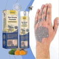 thumbnail image 4 of Soothing Moisturizing Psoriasises Liquid Portable Anti-itch Body Care Liquids Body Care Supplies, 4 of 5