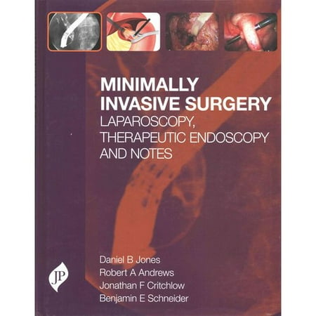 UPC: 9781907816192 | Minimally Invasive Surgery: Laparoscopy  Therapeutic Endoscopy And Notes [Hardcover] Jones  Daniel B. [May 11  2015] …