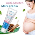 thumbnail image 2 of SIfdSeng Body Stretch Mark Refreshing Non Greasy Moisturizing to Growth Lines 60Ml, 2 of 6