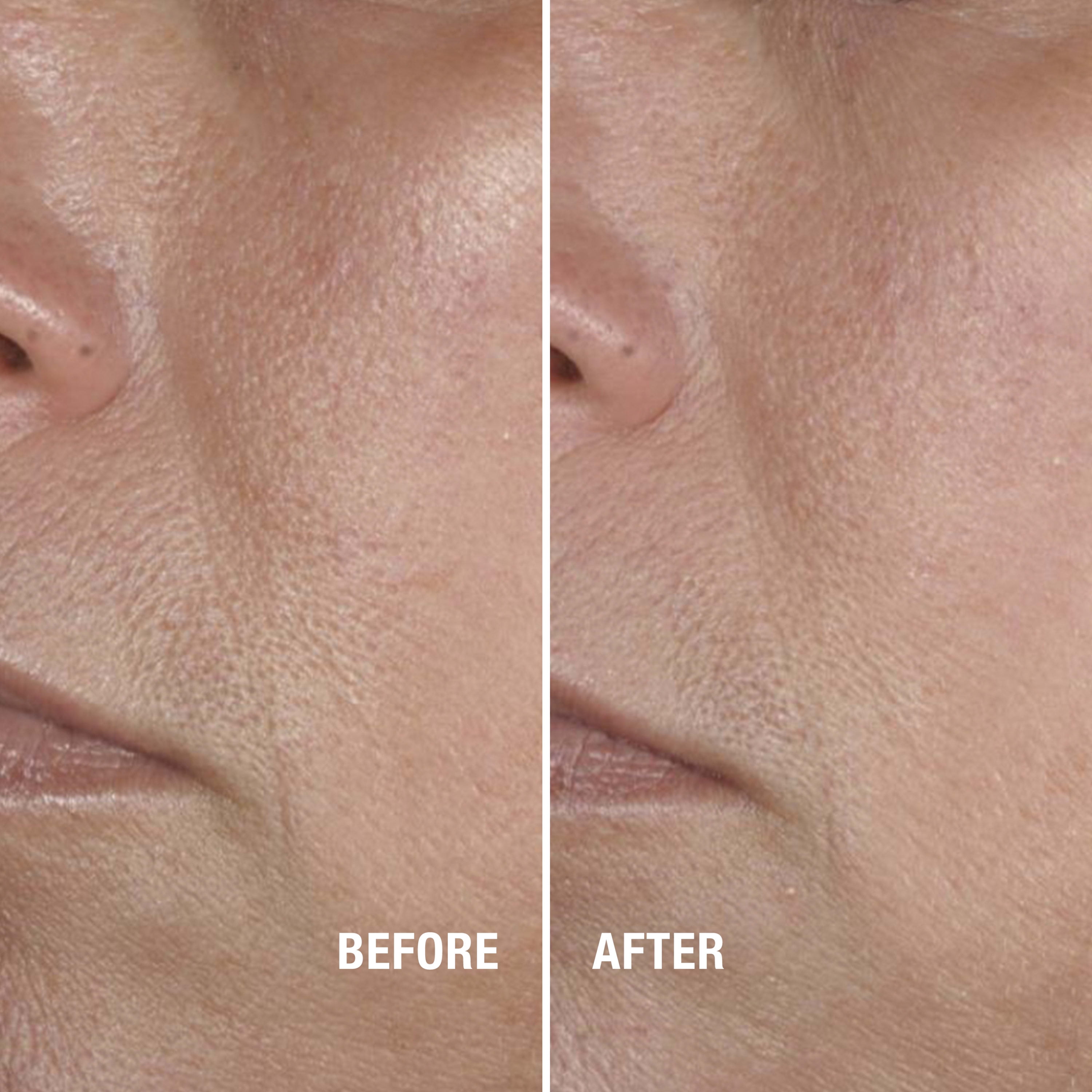 skin balancing neutrogena