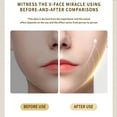 thumbnail image 2 of Intelligent Electric Double Chin and V-Shaped Face Machine with 12Adjustable Intensities - Women's V-Face Machine(white,25.6*4.5cm）, 2 of 5