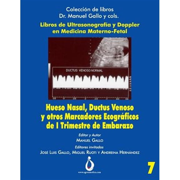 Pre-Owned Coleccion de Libros Dr. Manuel Gallo Y Cols: Hueso Nasal, Ductus Venoso y otros marcadores ecogrficos de I trimestre de Embarazo (Series #7) (Paperback)