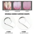thumbnail image 5 of Aoresac Tongue Scraper,Curved Shape Cleaner Shape Cleaner Kids Improve Oral Condition Reduce Bad Breath Stainless Steel Scraper Sided Curved Shape Steel Scraper Sided Oral Condition Reduce Daseey, 5 of 6