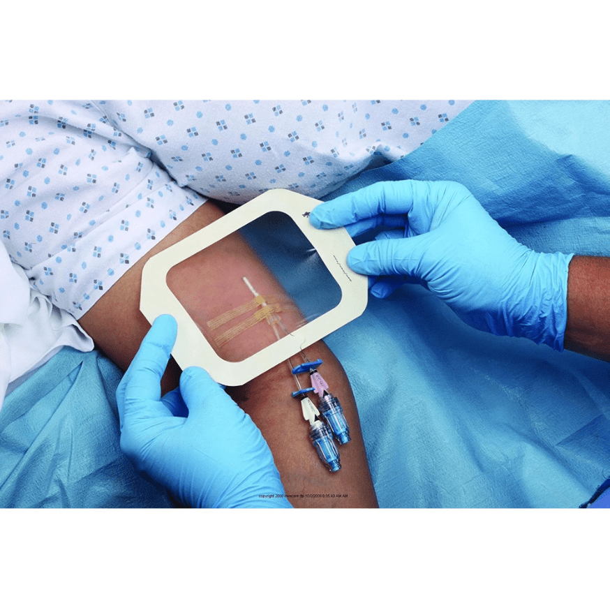 3M Tegaderm Transparent Film Dressing Picture Frame Style 4in x 4.75 in, 50 ct