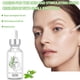 thumbnail image 4 of Buy 2 Save 10% Facial Essences With TeaTree Essences 30ml Essences Skin Essences To Tighten Pores, 4 of 9
