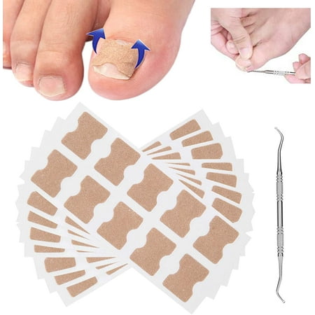 Toenail Correction Patch Glue Patch toe Correction Sticker Glue-free ...