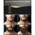 thumbnail image 6 of Beard Growth Kit, Derma Roller for Beard Growth,Beard Roller for Hair Growth for Men,Stimulate Promote Beard Mustache and Hair Regrowth - Gifts for Men Him Dad Father Boyfriend, 6 of 6