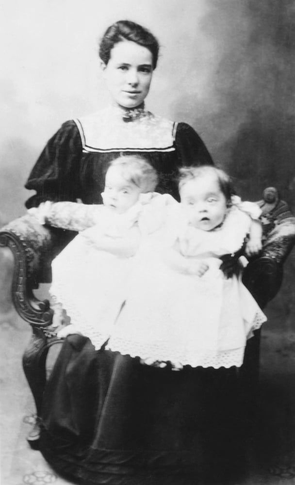 Daisy Hilton And Violet Hilton History 24 X 36 Walmart Com Walmart Com