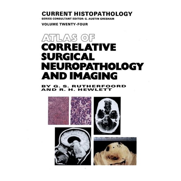 Current Histopathology Atlas of Correlative Surgical Neuropathology and Imaging, Book 24, (Paperback)