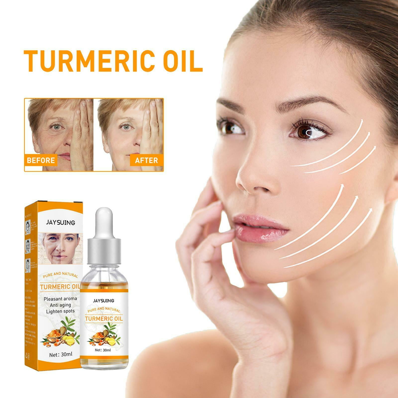 Turmeric Oil Skin Acne Clear Skin Dark Spot Corrector Serum Clean Face ...