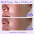 thumbnail image 5 of YEOUTH Hydrating Toner for Face Spray with Chamomile and Allantoin, Alcohol Free Refreshing Face Toner 3.4 Oz, 5 of 7