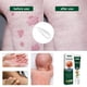 thumbnail image 2 of Crema calmante para herpes zóster de 20 g, crema para el tratamiento del herpes zóster y para aliviar el dolor del herpes zóster en el rostro y el cuerpo, bálsamo para aliviar el dolor del herpes zós, 2 of 4