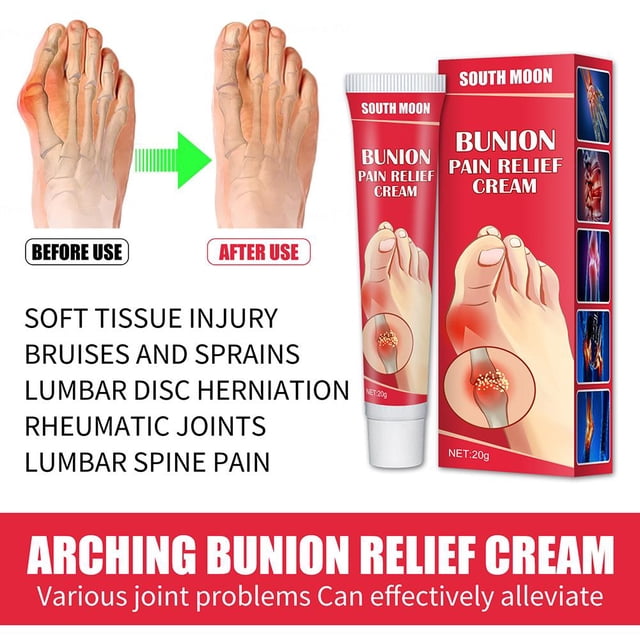 Tratamiento de la rigidez del alivio del dolor del dedo del pie de la crema del alivio del juanete arqueado 20g Ndcxsfigh Cuidado Belleza