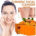 thumbnail image 4 of Xihbxyly Oferta de iluminación Barras de extremidades jabón facial y corporal de cúrcuma y jengibre hecho a mano - 3 piezas, 4 of 7