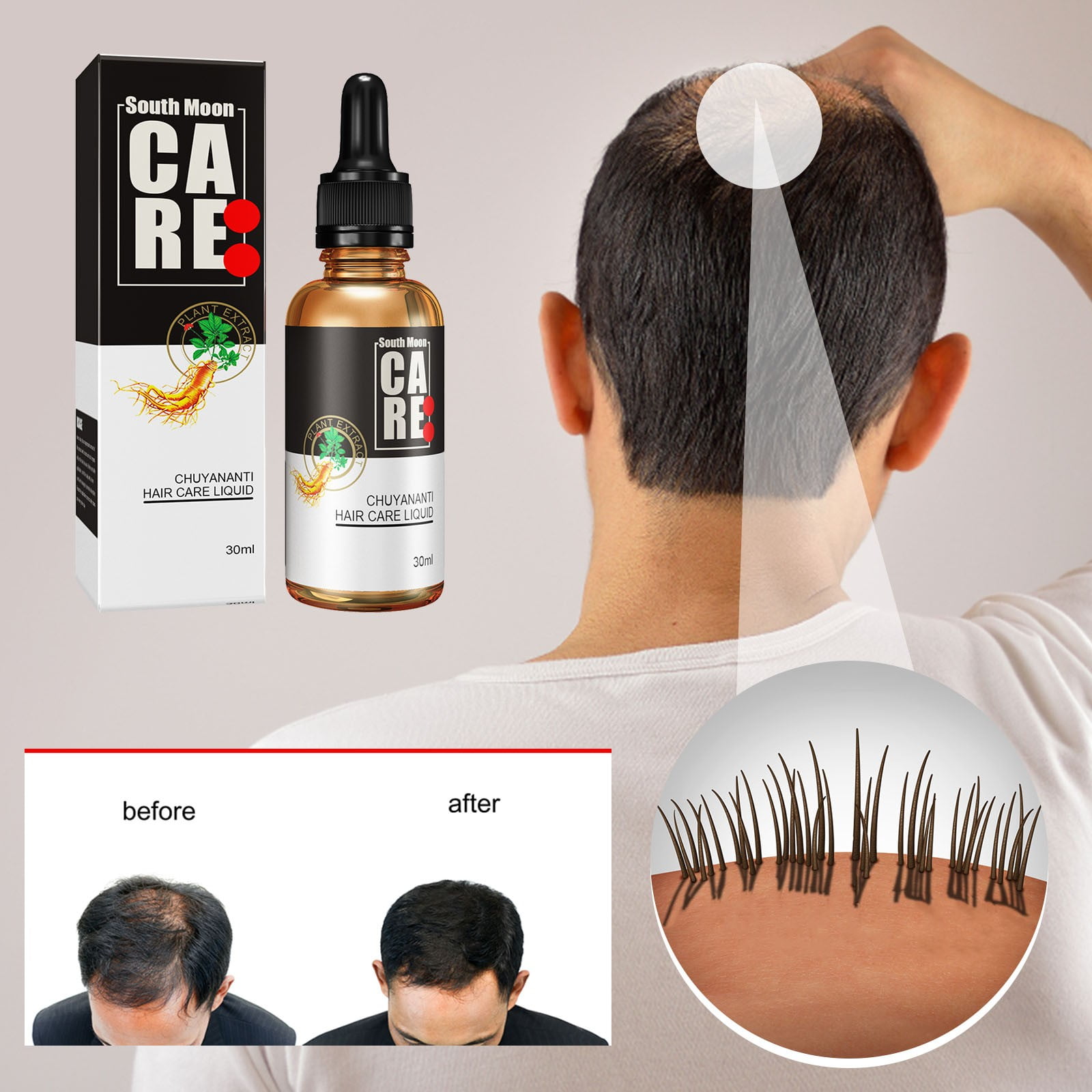 Hair Growth Serum Natural Plant Hair Growth Essence Oil for Thicker Longer  Fuller Healthier Hair, Strong Hair Care to Prevent Thinning & Hair Loss for  Men & Women, All Hair Types -