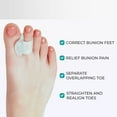 thumbnail image 2 of FERSWE Toe Separators Hammer Toe Straightener, Big Toe Spacers, Gel Spreader, Correct Crooked Toes, Bunion Corrector and Bunion Relief, Pads for Overlapping, Hallux Valgus, Yoga, 2 of 6