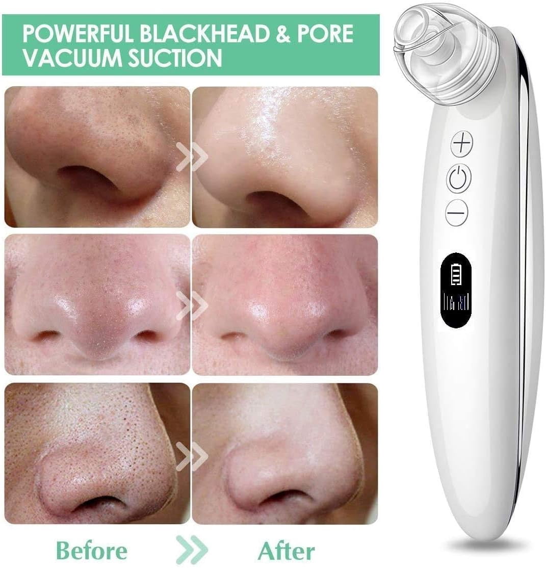 Blackhead Remover Vacuum—Electric Vacuum Suction Blackhead Remover W/LED Display—Powerful Facial Pore Vacuum Cleaner Tool for Blackhead, Whitehead&Acne Removal for Women and Men