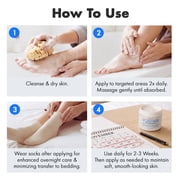 Ebanel Urea Cream 40% plus Salicylic Acid 2%, Foot Cream for Dry Cracked Heels Feet Knees Elbows Hands, Foot Dead Skin Cuticle Callus Remover Toenail Softener, Keratolytic Skin Barrier Repair