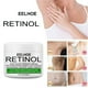 thumbnail image 1 of 10/20/30/50ml Cremas para aclarar la piel Hidratante para glúteos y rodillas para mujeres Ndcxsfigh Cuidado Belleza, 1 of 7